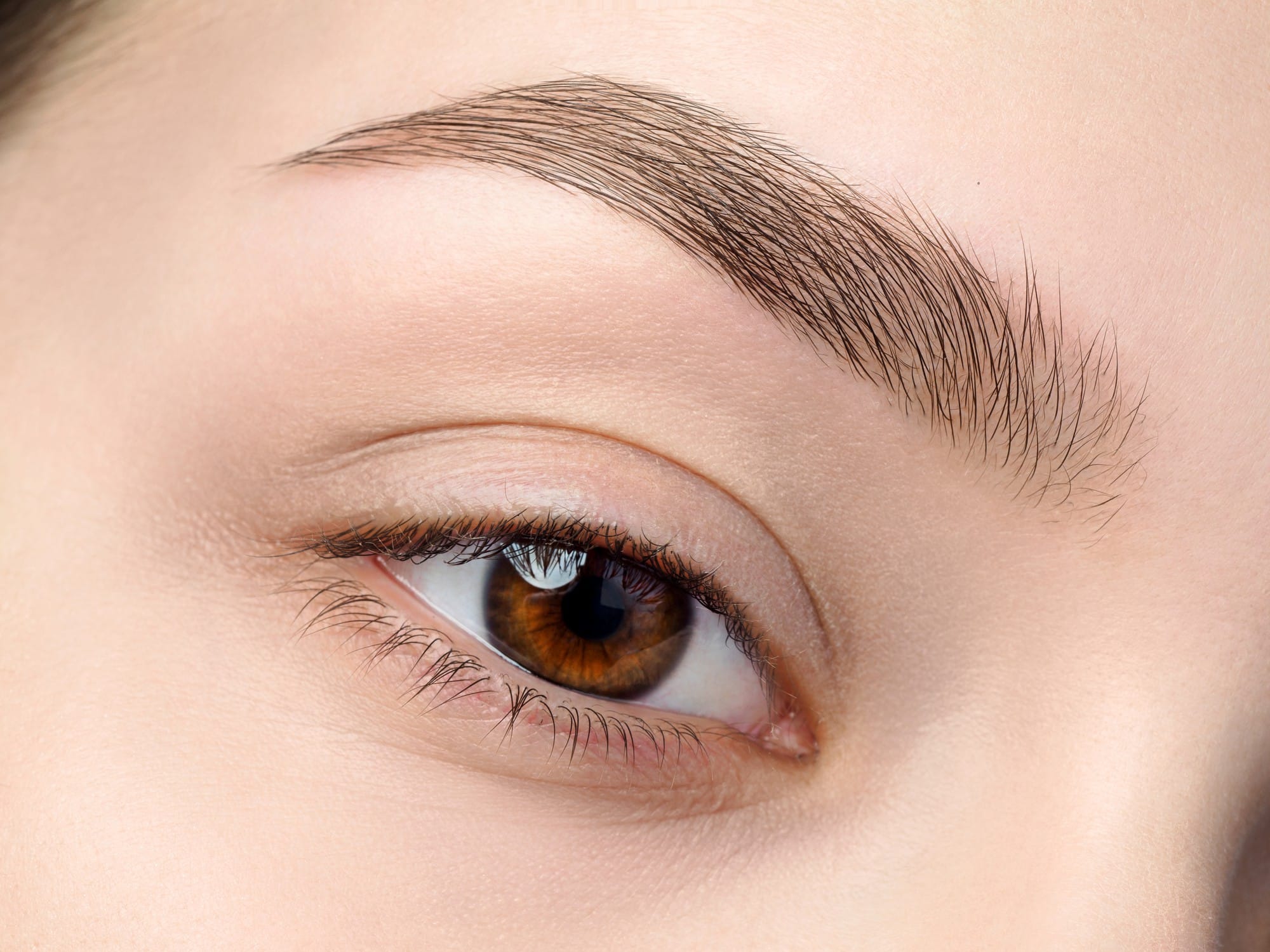 Brow Lifiting